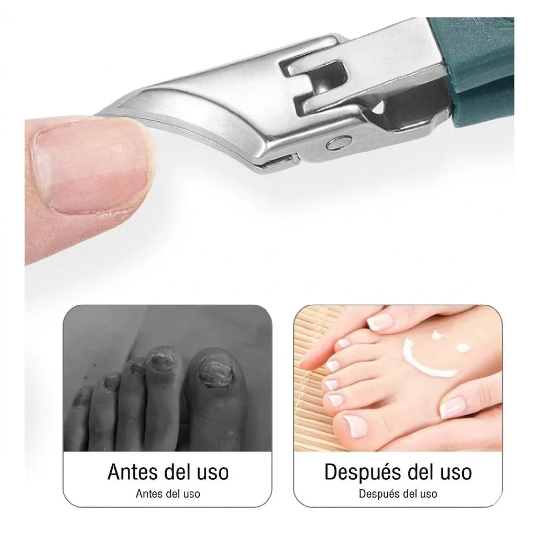 Kit Corta Uñas de Esquina + Estuche Protector: Sin dolor por uñas encarnadas